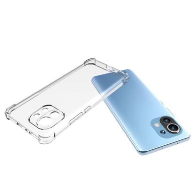 TPU чохол Protect для Xiaomi Mi 11 Lite