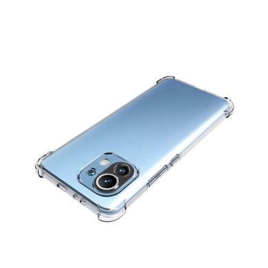 TPU чехол Protect для Xiaomi Mi 11 Lite