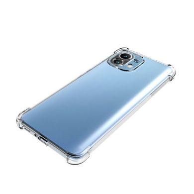TPU чехол Protect для Xiaomi Mi 11 Lite
