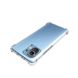 TPU чохол Protect для Xiaomi Mi 11 Lite (9082). Фото 8 із 10